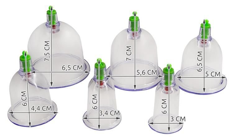 Chinese vacuum cupping-4